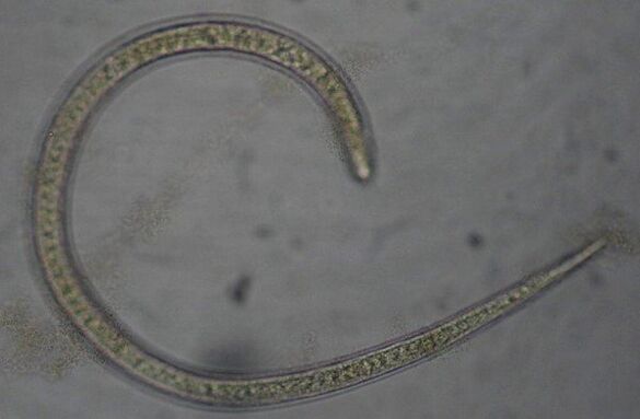 Trichinella ist ein protostomärer runder parasitärer Wurm