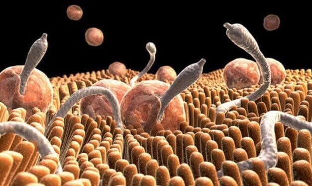 Parasiten