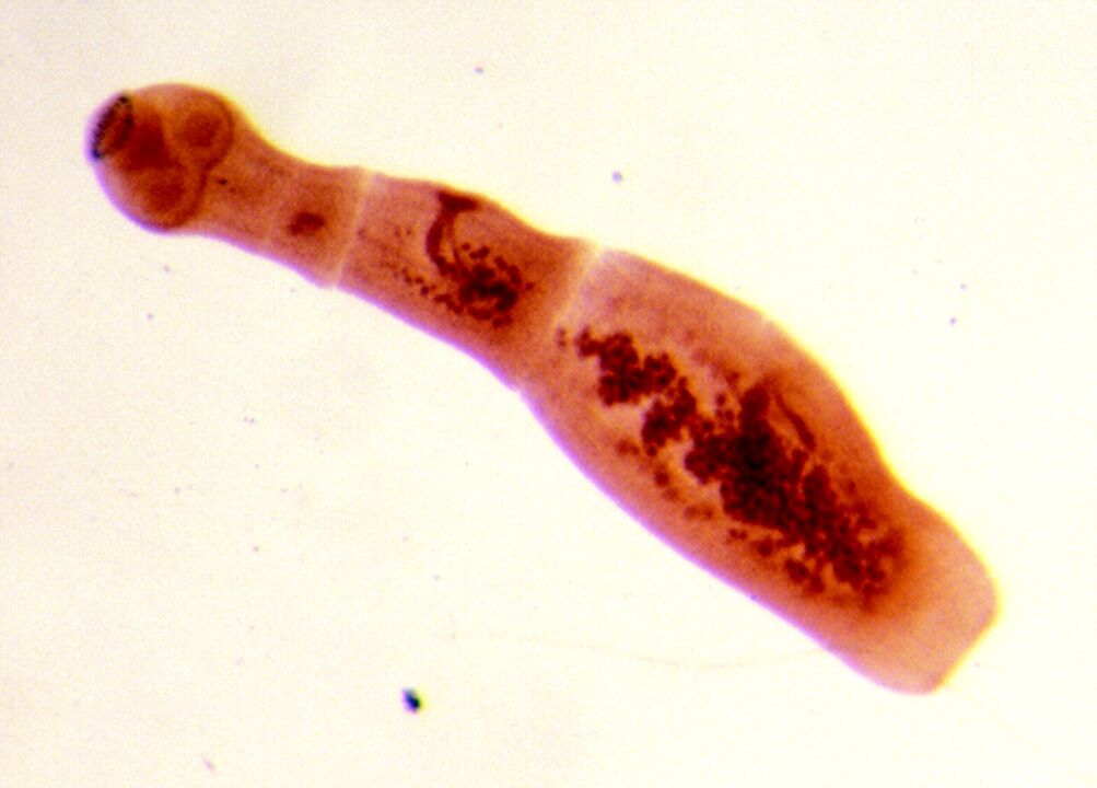 Echinococcus